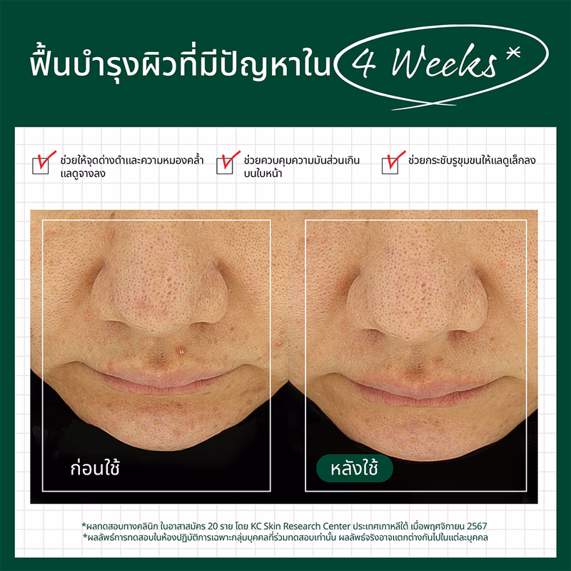 Dr.G R.E.D Blemish Hyal Cica Soothing Serum 50ml เซรั่มปลอบประโลมผิว