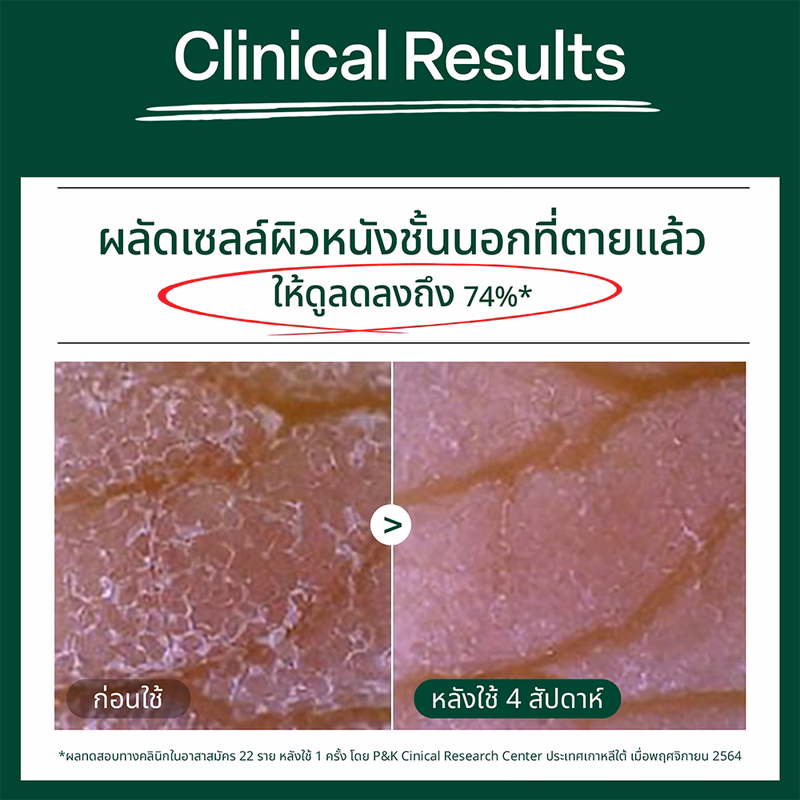 Dr.G BRIGHTENING PEELING GEL 120ML เจลผลัดเซลล์ผิวสูตรอ่อนโยน