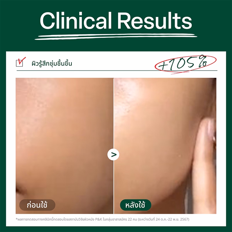 Dr.G R.E.D Blemish Soothing Up Sun SPF50+ PA++++ 50ml กันแดดปลอบประโลมผิวเนื้อน้ำ